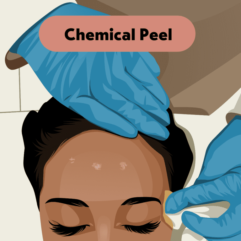 what is a chemical peel? what does a chemical peel do?