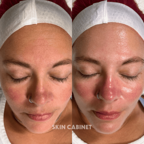 Before & After - Skin Cabinet