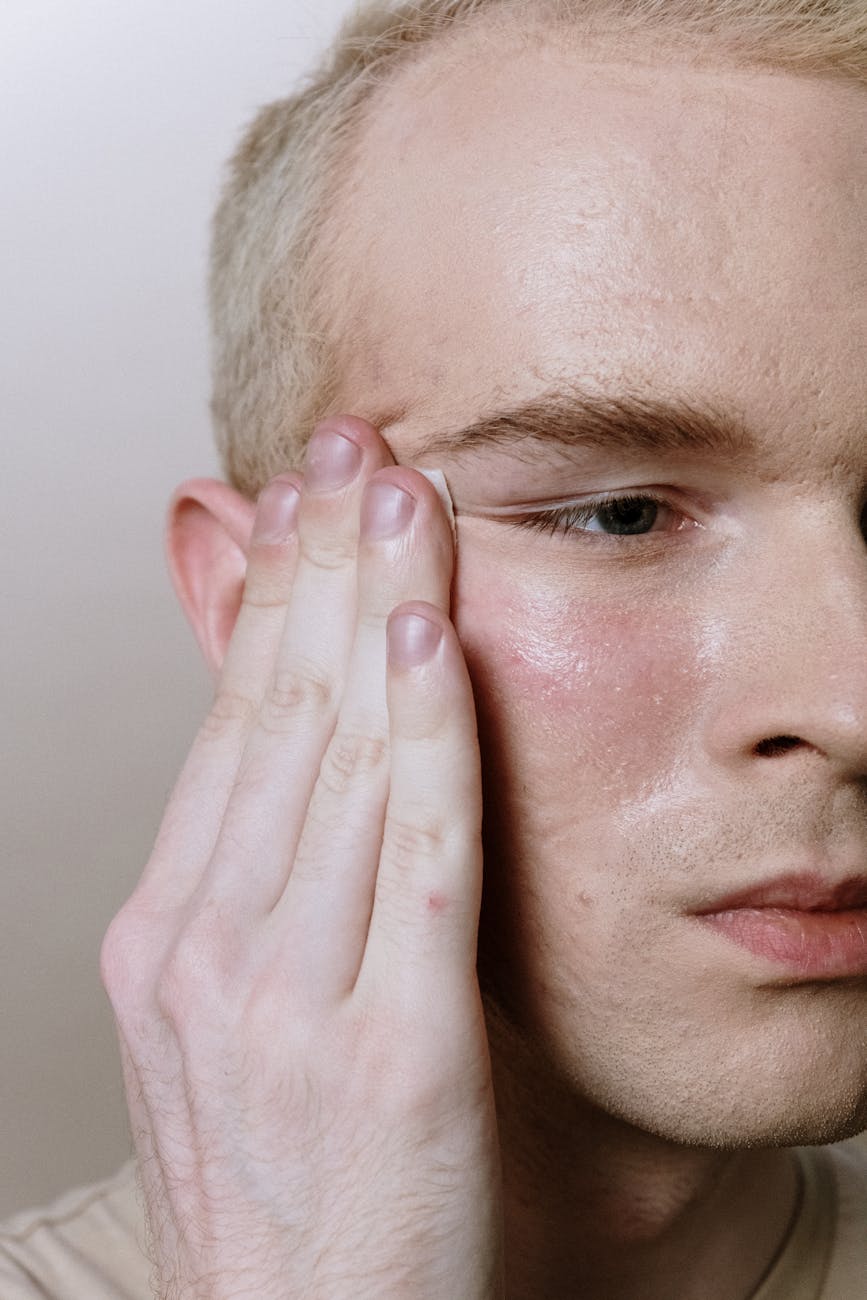 man with white hair covering his face