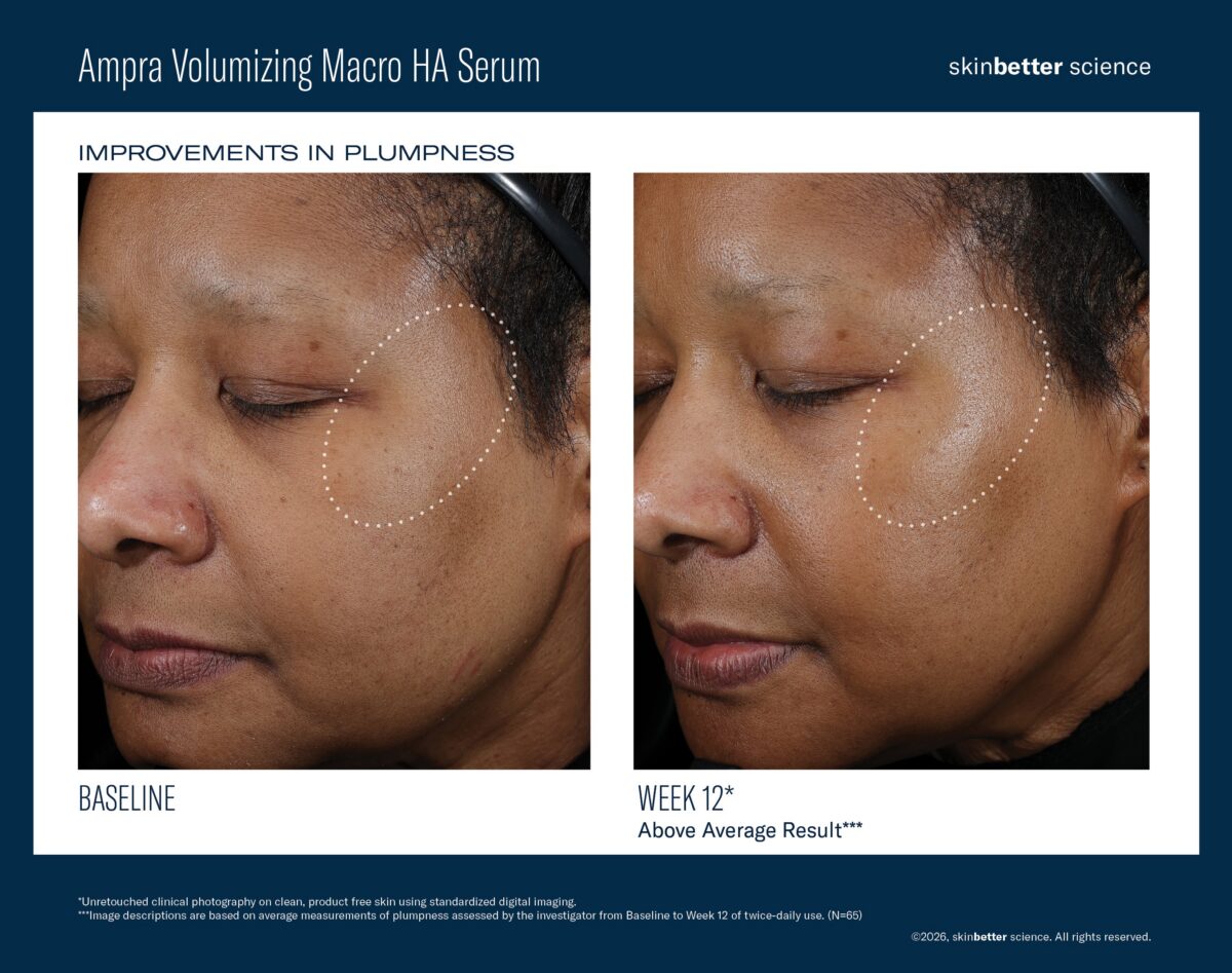 Ampra_before and After