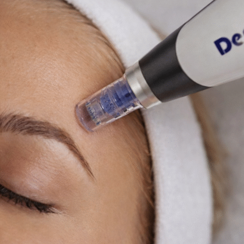 Microneedling